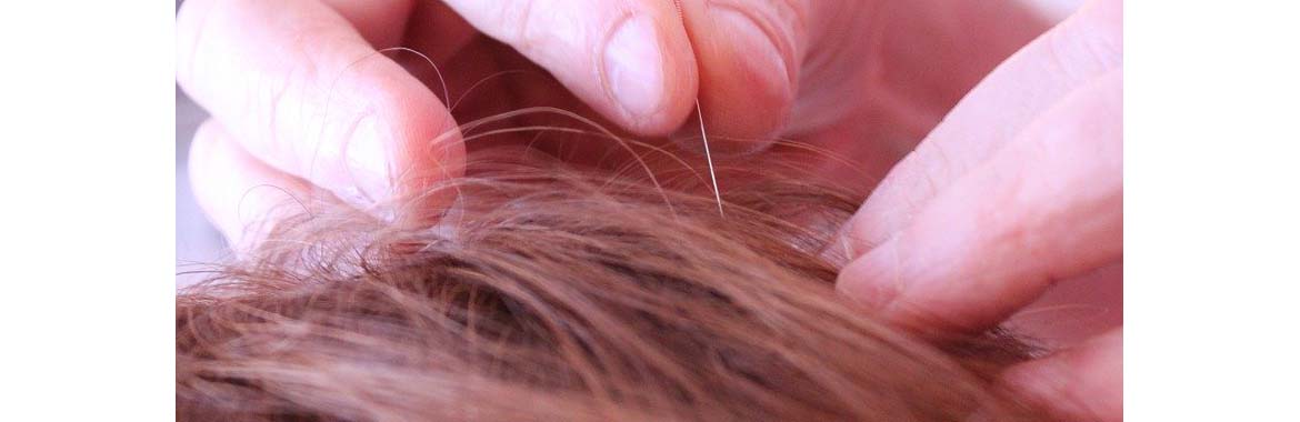 Animal acupuncture  banner